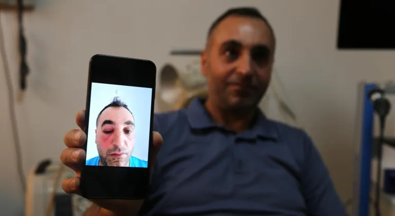 Bitlis'te gözyaşı kanalı tıkanıklığı endoskopik yöntemle tedavi edildi