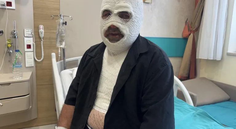 Hararet yapan araca acele müdahale ikinci derece yanığa neden oldu