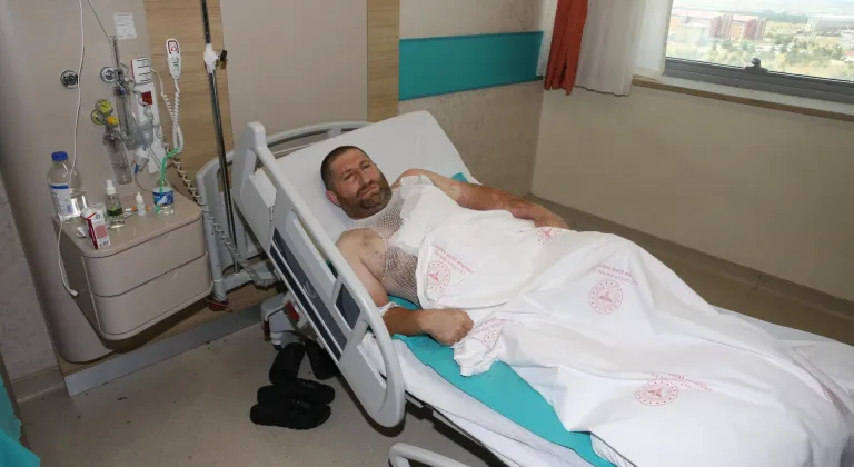 Yüksek gerilim hattında akıma kapılan Erzincanlı demir ustasının tedavisi sürüyor